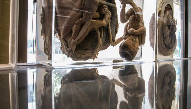 يعد متحف سيريراج الطبي، المعروف أيضًا باسم متحف الموت، مصدرًا قيمًا للمهنيين الطبيين والطلاب، ويعد من أهم متاحف بانكوك